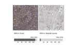Immunohistochemistry analysis in human tonsil and skeletal muscle tissues using Anti-MSN antibody. Corresponding MSN RNA-seq data are presented for the same tissues.