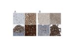 Immunohistochemical staining of human cerebral cortex, liver, lymph node and pancreas using Anti-SSR1 antibody HPA011276 (A) shows similar protein distribution across tissues to independent antibody HPA017062 (B).