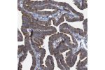 Immunohistochemical staining of human fallopian tube shows moderate cytoplasmic positivity in glandular cells.