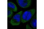 Immunofluorescent staining of human cell line A-431 shows localization to cytosol.