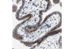 Immunohistochemical staining of human placenta shows strong cytoplasmic positivity in trophoblastic cells.