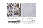 Immunohistochemistry analysis in human small intestine and skeletal muscle tissues using Anti-CASP6 antibody. Corresponding CASP6 RNA-seq data are presented for the same tissues.