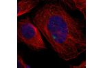 Immunofluorescent staining of human cell line U-2 OS shows localization to vesicles.