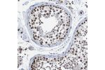 Immunohistochemical staining of human testis shows moderate to strong nuclear positivity in cells in seminiferous ducts.