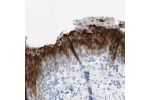 Immunohistochemical staining of human urinary bladder shows strong cytoplasmic and membranous positivity in urothelial cells.