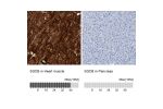Immunohistochemistry analysis in human heart muscle and pancreas tissues using HPA011422 antibody. Corresponding SGCB RNA-seq data are presented for the same tissues.