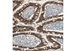Immunohistochemical staining of human small intestine shows distinct membranous positivity in glandular cells.