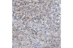Immunohistochemical staining of human adrenal gland shows moderate membranous positivity in glandular cells.