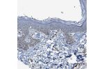Immunohistochemical staining of human skin shows cytoplasmic positivity in basal cells.