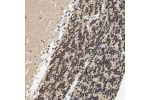 Immunohistochemical staining of human cerebellum shows strong nuclear positivity in cells in granular layer.
