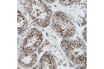 Immunohistochemical staining of human testis shows moderate to strong nuclear positivity in cells in seminiferous ducts.