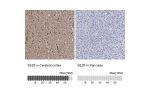 Immunohistochemistry analysis in human cerebral cortex and pancreas tissues using Anti-SEZ6 antibody. Corresponding SEZ6 RNA-seq data are presented for the same tissues.