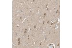 Immunohistochemical staining of human cerebral cortex shows moderate to strong cytoplasmic positivity in neurons.