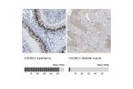 Immunohistochemistry analysis in human epididymis and skeletal muscle tissues using Anti-CUL4B antibody. Corresponding CUL4B RNA-seq data are presented for the same tissues.