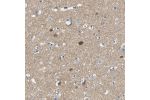Immunohistochemical staining of human cerebral cortex shows moderate positivity in neuropil.