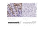 Immunohistochemistry analysis in human small intestine and stomach tissues using HPA011897 antibody. Corresponding SI RNA-seq data are presented for the same tissues.