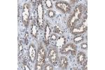 Immunohistochemical staining of human kidney shows moderate cytoplasmic positivity in cells in tubules.