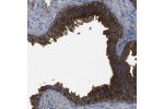 Immunohistochemical staining of human prostate shows strong cytoplasmic and membranous positivity in glandular cells.