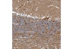 Immunohistochemical staining of human cerebellum shows moderate positivity in neuropil as well as in a subset of neurons.