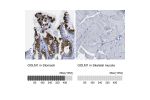 Immunohistochemistry analysis in human stomach and skeletal muscle tissues using Anti-GOLM1 antibody. Corresponding GOLM1 RNA-seq data are presented for the same tissues.