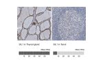 Immunohistochemistry analysis in human thyroid gland and tonsil tissues using HPA011949 antibody. Corresponding SIL1 RNA-seq data are presented for the same tissues.