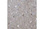 Immunohistochemical staining of human cerebral cortex shows strong cytoplasmic positivity in granular pattern in neuronal cells.