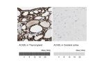 Immunohistochemistry analysis in human thyroid gland and cerebral cortex tissues using HPA011990 antibody. Corresponding ACADL RNA-seq data are presented for the same tissues.