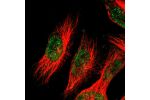 Immunofluorescent staining of human cell line U-251 MG shows localization to nucleoplasm.