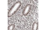 Immunohistochemical staining of human endometrium shows strong nuclear positivity in glandular cells.