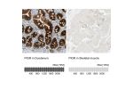Immunohistochemistry analysis in human duodenum and skeletal muscle tissues using HPA012012 antibody. Corresponding PIGR RNA-seq data are presented for the same tissues.