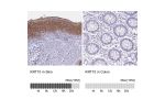 Immunohistochemistry analysis in human skin and colon tissues using HPA012014 antibody. Corresponding KRT10 RNA-seq data are presented for the same tissues.