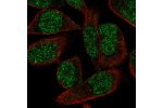 Immunofluorescent staining of human cell line RH-30 shows localization to nucleoplasm.