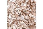 Immunohistochemical staining of human placenta shows strong nuclear positivity in trophoblastic cells.