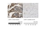 Immunohistochemistry analysis in human small intestine and skeletal muscle tissues using Anti-LASP1 antibody. Corresponding LASP1 RNA-seq data are presented for the same tissues.