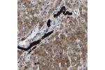 Immunohistochemical staining of human liver shows strong cytoplasmic positivity in bile ducts.