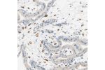 Immunohistochemical staining of human placenta shows moderate to strong cytoplasmic positivity in Hofbauer cells.