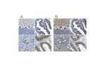 Immunohistochemical staining of human cerebellum, fallopian tube, kidney and testis using Anti-STIM1 antibody HPA012123 (A) shows similar protein distribution across tissues to independent antibody HPA011088 (B).