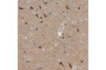 Immunohistochemical staining of human cerebral cortex shows strong cytoplasmic positivity in neurons.