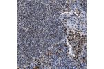 Immunohistochemical staining of human lymph node shows strong cytoplasmic positivity in reaction center cells and lymphoid cells outside reaction centra.