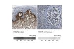 Immunohistochemistry analysis in human skin and pancreas tissues using Anti-POSTN antibody. Corresponding POSTN RNA-seq data are presented for the same tissues.