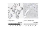Immunohistochemistry analysis in human lung and skeletal muscle tissues using HPA012368 antibody. Corresponding CD93 RNA-seq data are presented for the same tissues.