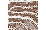 Immunohistochemical staining of human colon shows strong cytoplasmic positivity in glandular cells.