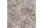 Immunohistochemical staining of human caudate nucleus shows moderate membranous positivity in neuropil.