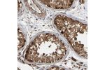 Immunohistochemical staining of human testis shows strong cytoplasmic positivity in cells in seminiferous ducts.
