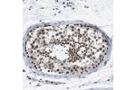 Immunohistochemical staining of human testis shows strong nuclear positivity in cells in seminiferous ducts.