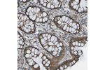 Immunohistochemical staining of human colon shows cytoplasmic positivity in glandular cells.