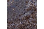 Immunohistochemical staining of human lymph node shows moderate to strong cytoplasmic positivity in non-germinal center cells.