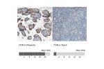 Immunohistochemistry analysis in human placenta and tonsil tissues using HPA012568 antibody. Corresponding PVR RNA-seq data are presented for the same tissues.