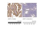 Immunohistochemistry analysis in human prostate and endometrium tissues using Anti-AZGP1 antibody. Corresponding AZGP1 RNA-seq data are presented for the same tissues.