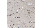 Immunohistochemical staining of human Cerebral cortex shows moderate granular cytoplasmic positivity in neuronal cells.